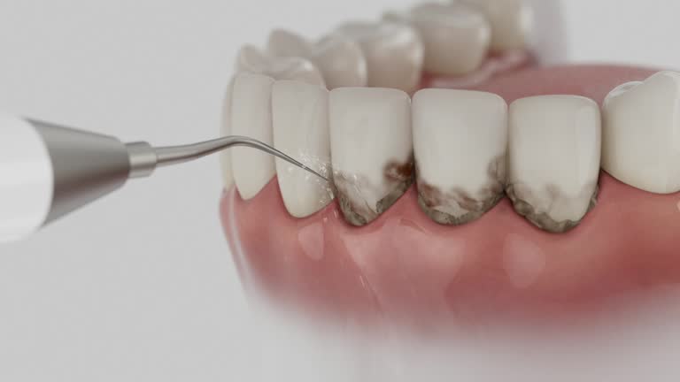 Reliable Dental contractor in Larkfield-Wikiup, CA by Dentist Open Now